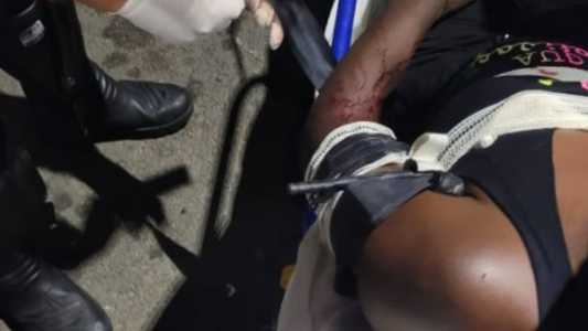 Hoje, a mulher continua internada mas está fora de perigo