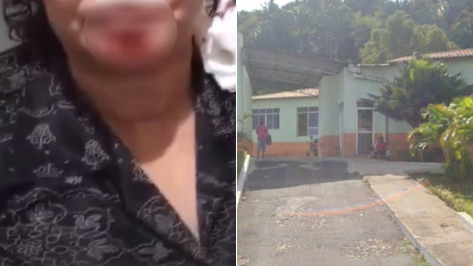 Homem é preso após dar mata-leão e arrancar pedaço do queixo da companheira com mordida
