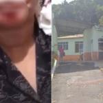Homem é preso após dar mata-leão e arrancar pedaço do queixo da companheira com mordida