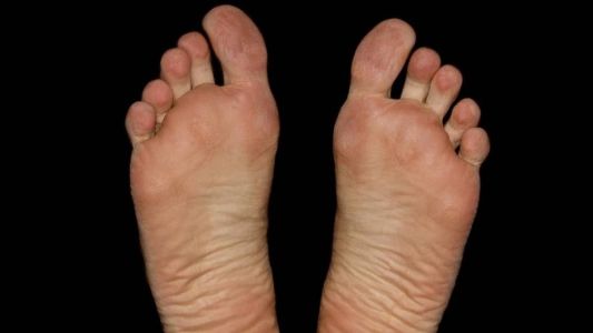 Homem quebrou os dois pés ao fugir de marido traído em Timóteo, Vale do Aço