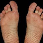 Amante quebra os dois pés ao cair de prédio para fugir do marido traído em MG