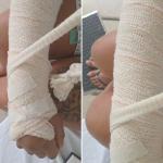Manicure internada no Hospital Maria Amélia Lins à espera de cirurgia desabafa: ‘Descaso’