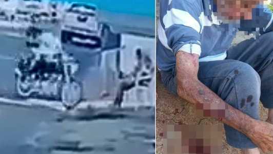 Idoso estava sentado em calçada quando foi atropelado motociclista