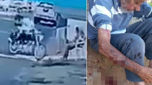 Idoso estava sentado em calçada quando foi atropelado motociclista