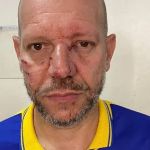 Vereador é atacado por cachorro enquanto trabalhava como carteiro no interior de Minas