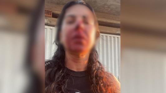 Três focos de incêndio voltam a atingir a Serra do Curral, agora no Bairro Sion, Zona Sul de Belo Horizonte, na tarde desta quarta-feira. Dezoito militares estão no local tentando controlar o fogo.