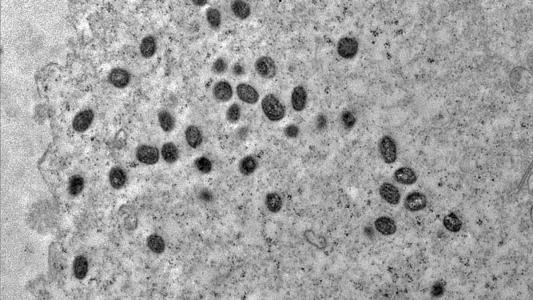 Imagens em microscópio do vírus causador da monkeypox