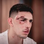 Federação Cearense pede que STJD proíba jogos em Pernambuco após ataque ao Fortaleza