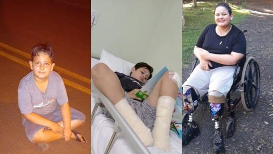 Infecção generalizada: criança sofre acidente de skate e precisa amputar as pernas