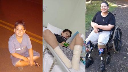 Infecção generalizada: criança sofre acidente de skate e precisa amputar as pernas