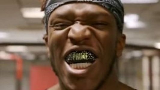 Influenciador usará protetor bucal 'mais caro do mundo'