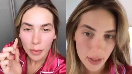 Influenciadora mostrou vermelhidão no rosto e explicou que doença piora em casos de estresse