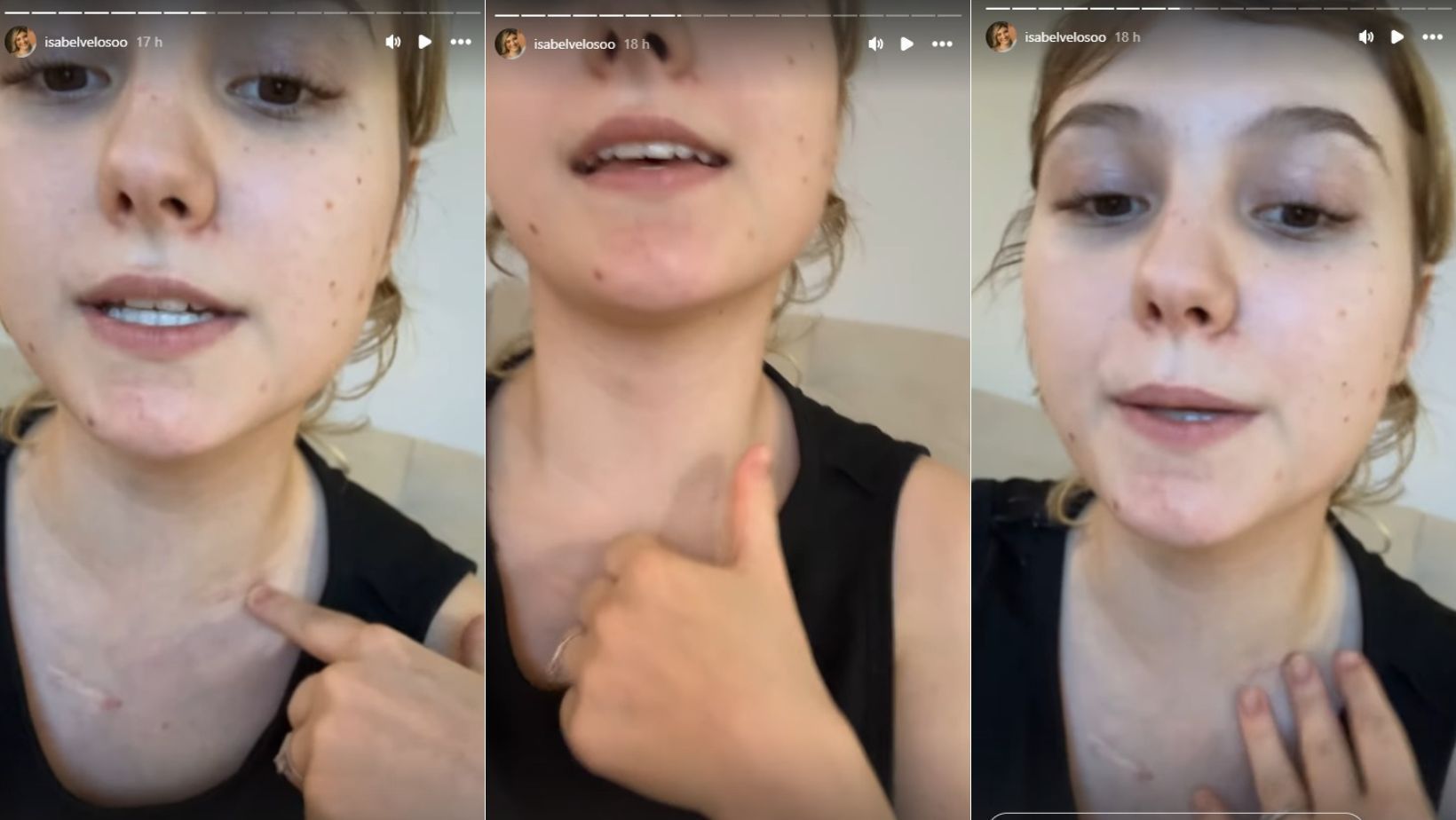 Isabel Veloso, influencer com câncer terminal, fala sobre pescoço inchado devido a um 'caroção'