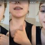 Isabel Veloso, influencer com câncer terminal, fala sobre pescoço inchado devido a um 'caroção'