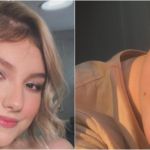 Isabel Veloso com câncer terminal; saiba o que é Linfoma de Hodgkin, sintomas e chances de cura