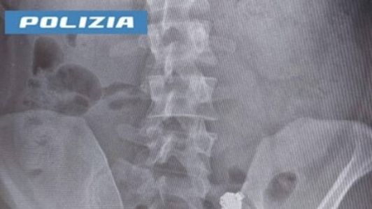 Italiano engoliu fone após ser flagrado colando em teste