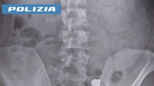 Italiano engoliu fone após ser flagrado colando em teste