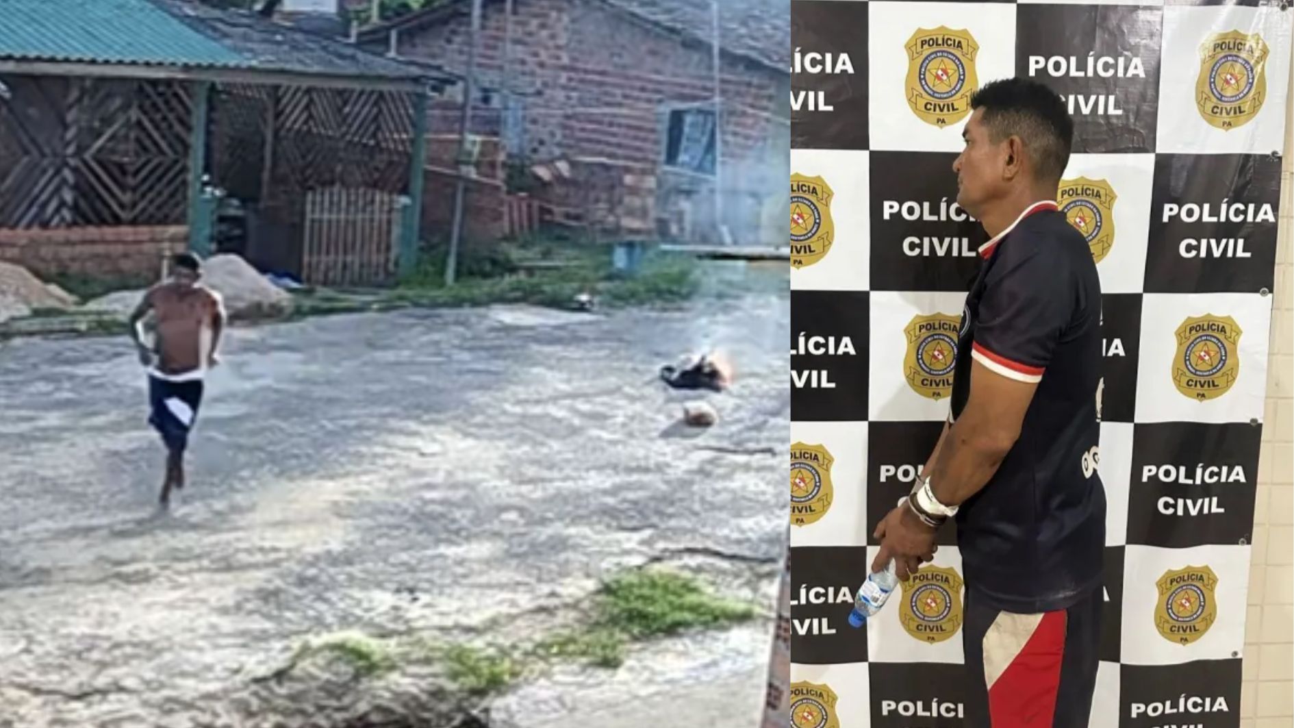 Homem ateia fogo em companheira e foge; mulher teve 70% do corpo queimado