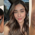 Empresária de BH diz que foi espancada por ex-companheiro na noite de Ano Novo 