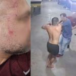 Arquidiocese de BH se posiciona sobre suposto companheiro de padre que espancou homem