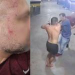 Arquidiocese de BH se posiciona sobre suposto companheiro de padre que espancou homem