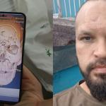 Motociclista que teve crânio 'triturado' em acidente explica cirurgia complexa