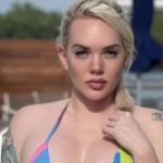 Modelo tem perna amputada após contrair 'bactéria comedora de carne'