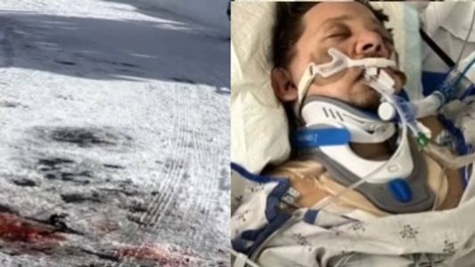 Jeremy mostrou local de acidente e como ficou irreconhecível em hospital