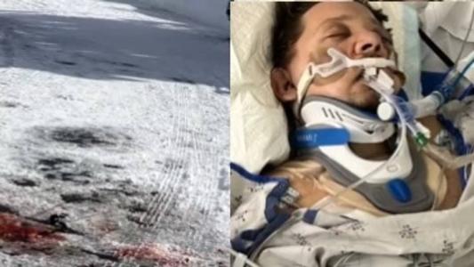 Jeremy mostrou local de acidente e como ficou irreconhecível em hospital