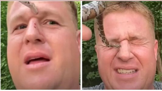 Jesse deixa-se picar e dá risada a cada investida da cobra