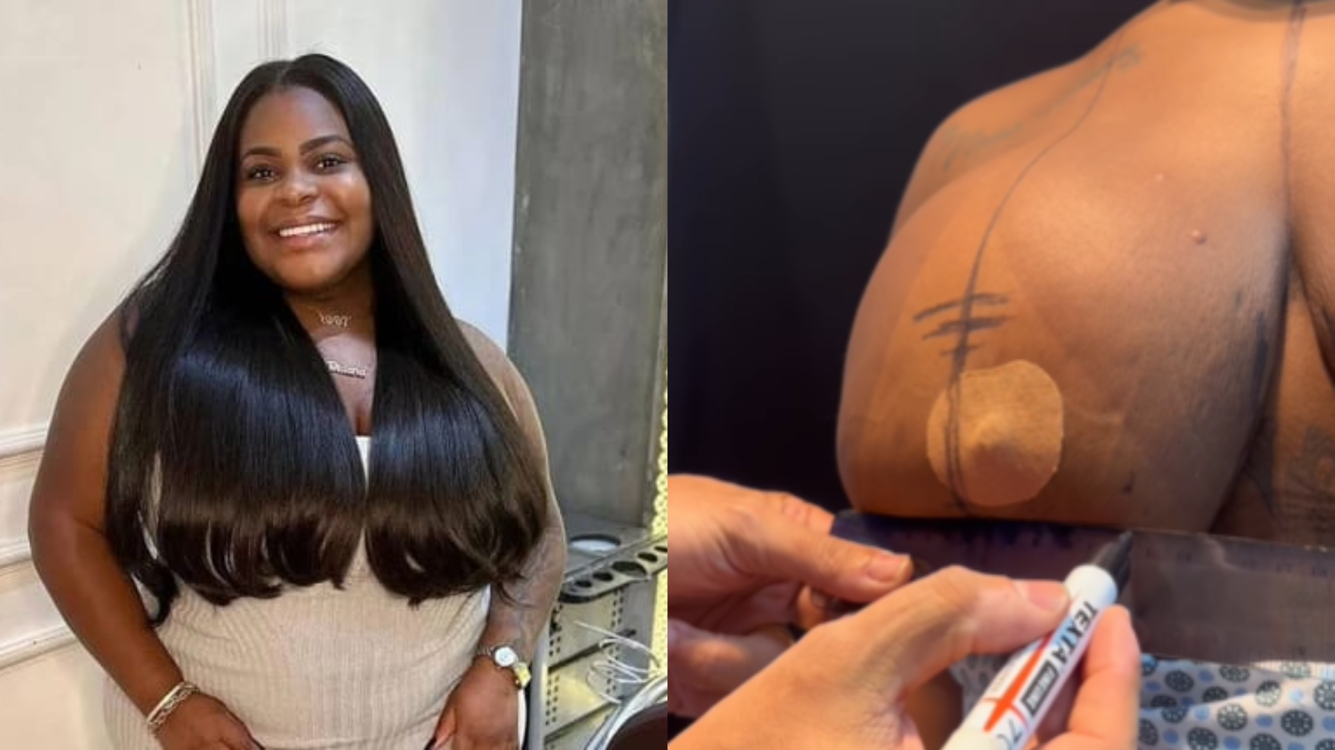 Vídeo: Jojo Todynho mostra cirurgia que fez para redução de mamas