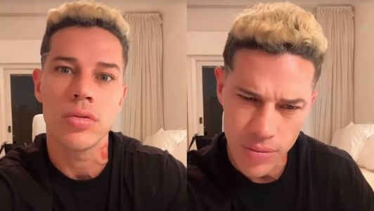 José Loreto se pronuncia sobre sua saúde após cirurgia