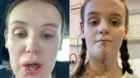 Após ser curada da doença, Rachel Morton se dedica a ajudar pessoas com câncer