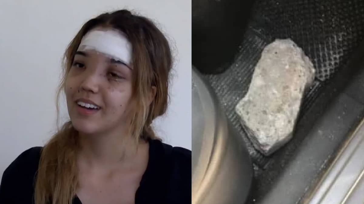 Advogada que foi atingida por paralelepípedo recebe alta: ‘grata porque estou viva’