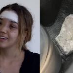 Advogada que foi atingida por paralelepípedo recebe alta: ‘grata porque estou viva’