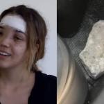 Advogada que foi atingida por paralelepípedo recebe alta: ‘grata porque estou viva’