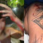 Cantora leva garrafada na cabeça ao defender amiga de assédio em boate de BH