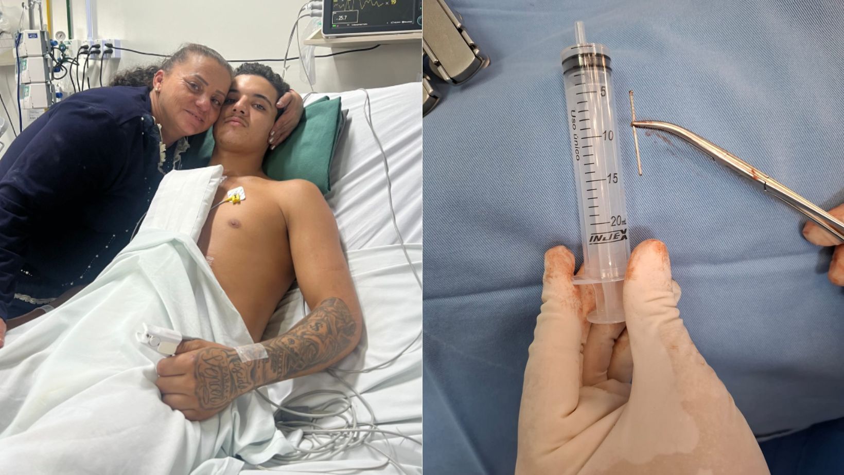 Jovem de 17 anos dispara sem querer pistola de pregos no próprio coração, em SC