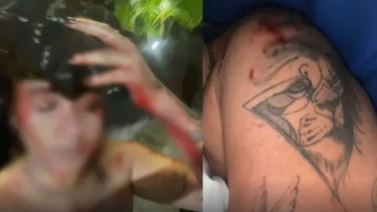 Jovem levou onze pontos na cabeça