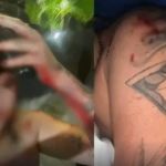 Cantora leva garrafada na cabeça em BH: 'nós, mulheres, não estamos seguras', lamentou 
