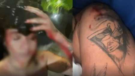 Jovem levou onze pontos na cabeça