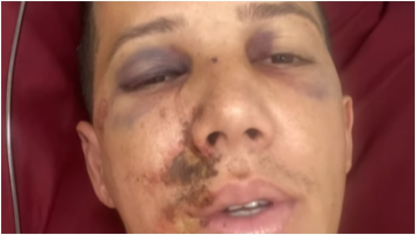 Árbitro desabafa após ser agredido em Minas: 'Estou em cama de hospital'