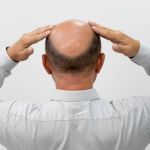 Homem calvo pede para usar boné em prédios públicos, mas juiz nega