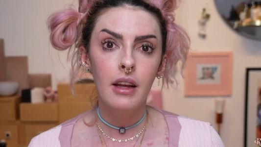 Karen Bachini revelou que descobriu ser intersexo recentemente