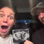 Caso raro: mulher engravida com um gêmeo em cada útero 