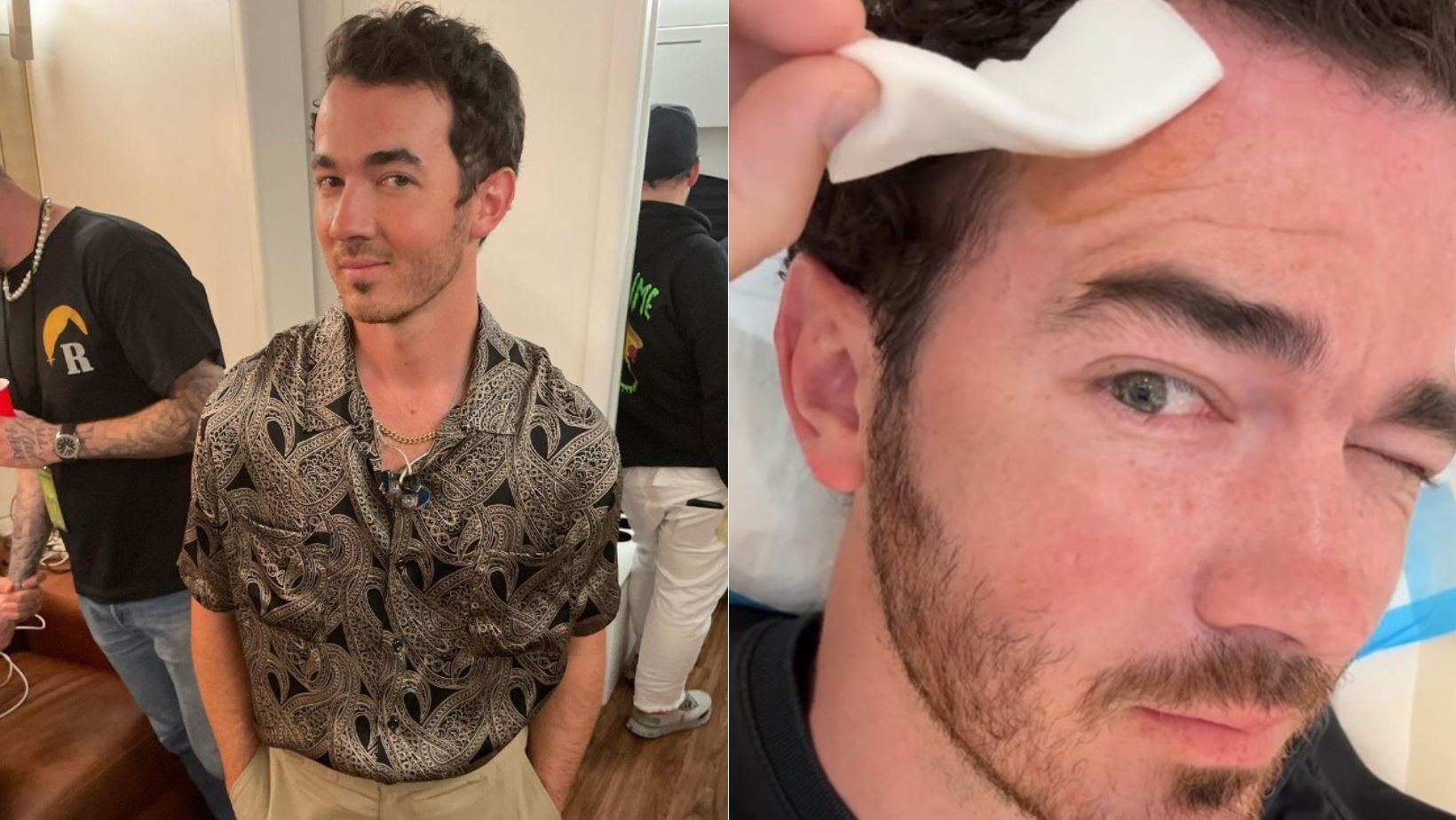 Kevin Jonas é diagnosticado com câncer de pele e precisa passar por cirurgia