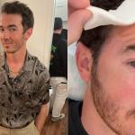 Kevin Jonas é diagnosticado com câncer de pele e precisa passar por cirurgia