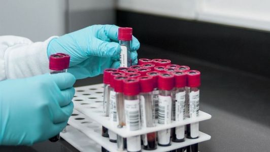 Pernambuco confirma caso de raiva humana após 8 anos sem registros da doença | CNN Brasil