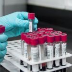 Pernambuco confirma caso de raiva humana após 8 anos sem registros da doença