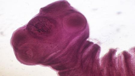 A neurocisticercose (NCC), causada pela larva da Taenia solium, é considerada a maior causa de epilepsia adquirida em regiões endêmicas, como América Latina, Ásia e África